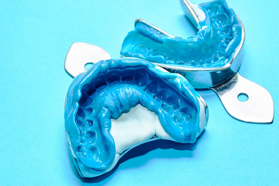dental bite 01