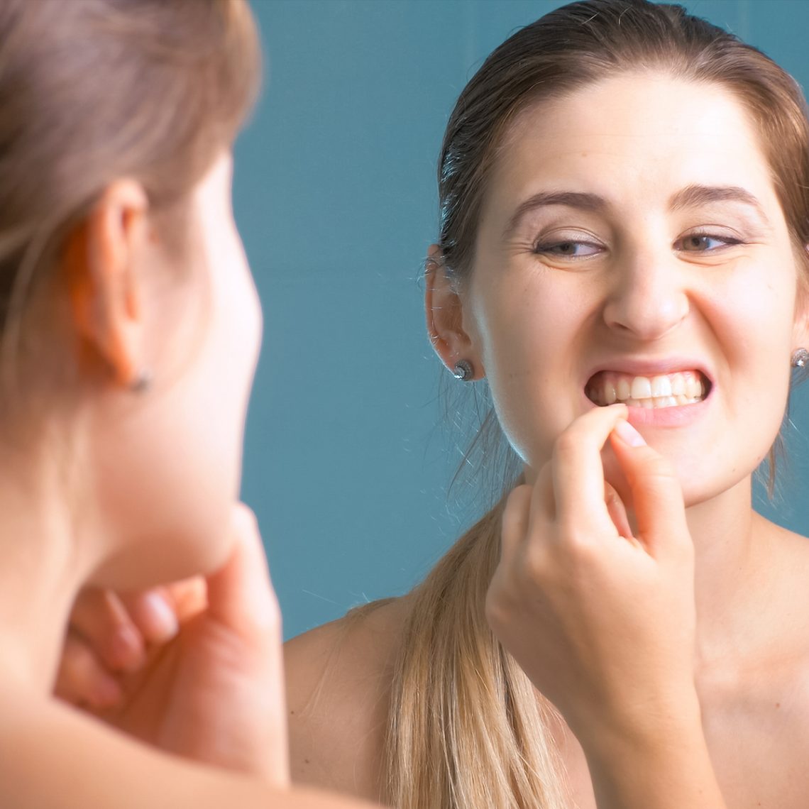 teeth whitening options in winchster va