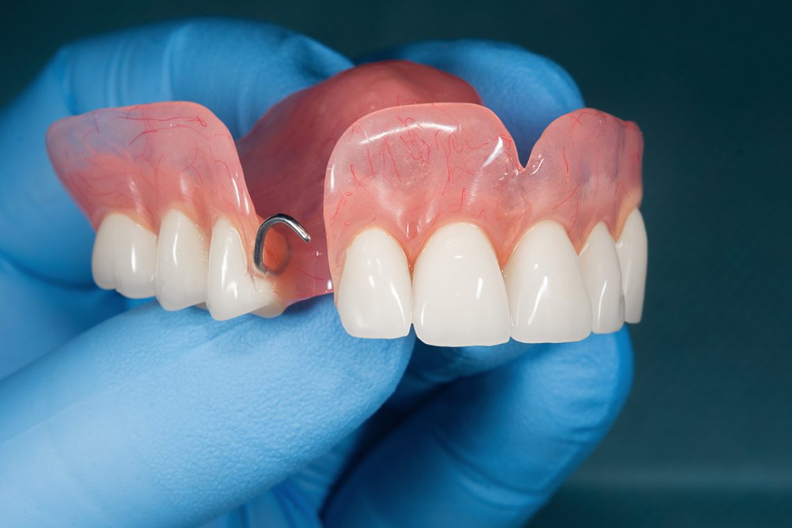Close up view of dentures
