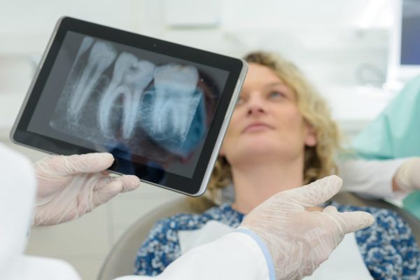 dental xrays